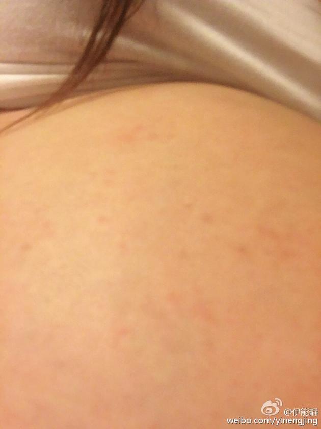 伊能靜臨產腳腫肚子過敏 伊能靜臨產腳腫肚子過敏
