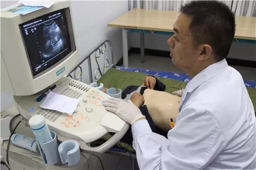 B超檢查 B超檢查