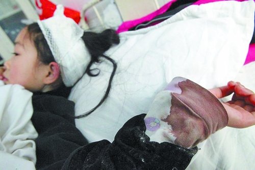 鑫鑫內衣袖子上的血跡清晰可見