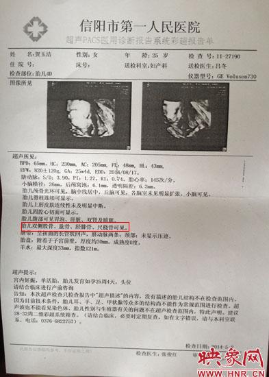 胎兒醫院四維彩超顯示一切正常 出生后肢體殘缺