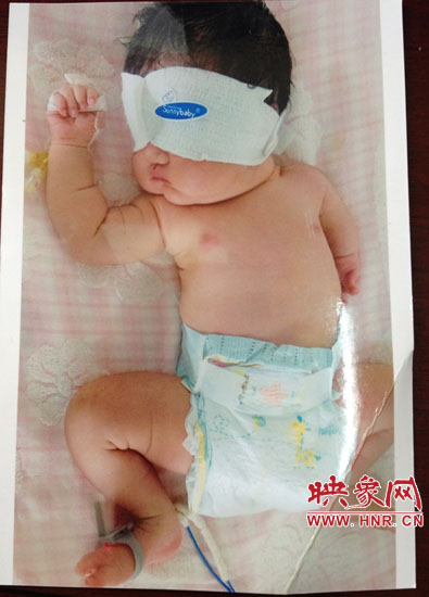 胎兒醫院四維彩超顯示一切正常 出生后肢體殘缺