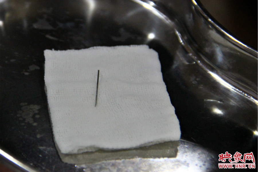 上午11點(diǎn)30分許,小龍腦中鋼針已經(jīng)成功取出。 上午11點(diǎn)30分許,小龍腦中鋼針已經(jīng)成功取出。