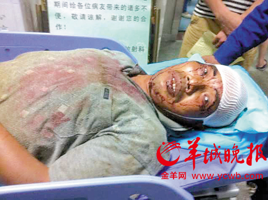 57歲的黃武明可能面臨傷殘 57歲的黃武明可能面臨傷殘