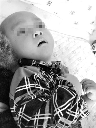 9月10日，陳揚(yáng)躺在醫(yī)院的病床上，他的眼睛仍然沒(méi)有聚焦感。新京報(bào)記者 朱柳笛 攝