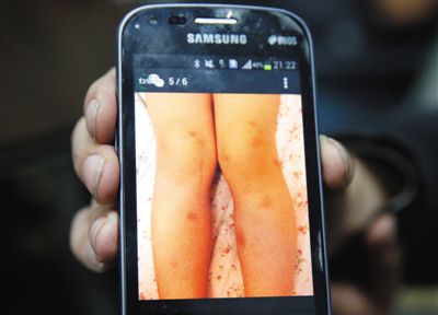 朝陽一幼兒園 女老師長期打多名兒童 朝陽一幼兒園 女老師長期打多名兒童