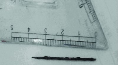 取出的繡花針已發黑生銹。 取出的繡花針已發黑生銹。