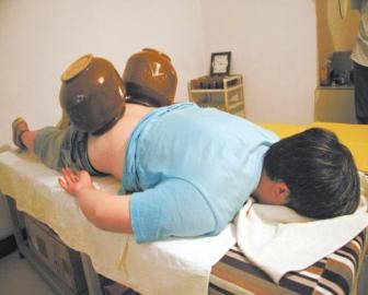 拔泡菜壇子火罐。 拔泡菜壇子火罐。