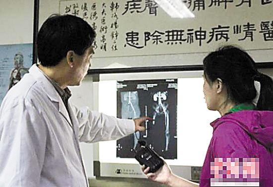 河北自鋸腿農民已確定治療初步方案