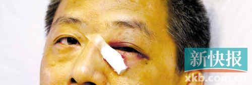 ■這起醫(yī)鬧事件，受傷的遠遠不只是熊旭明醫(yī)生的身體。