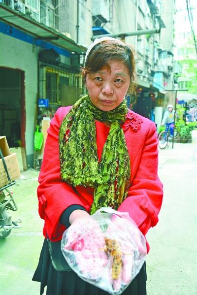 頭部受傷的黃女士展示兩根大魚刺。