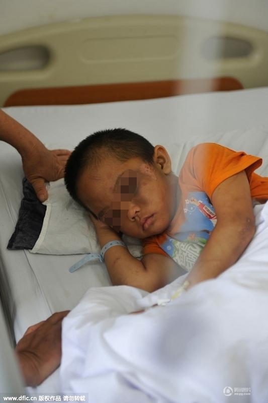 圖為全身傷痕累累的小進(jìn)。 圖為全身傷痕累累的小進(jìn)。