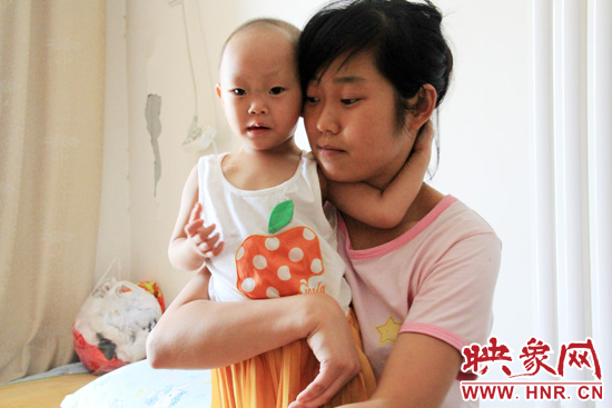 孩子和媽媽在一起，她的右眼已經失明。