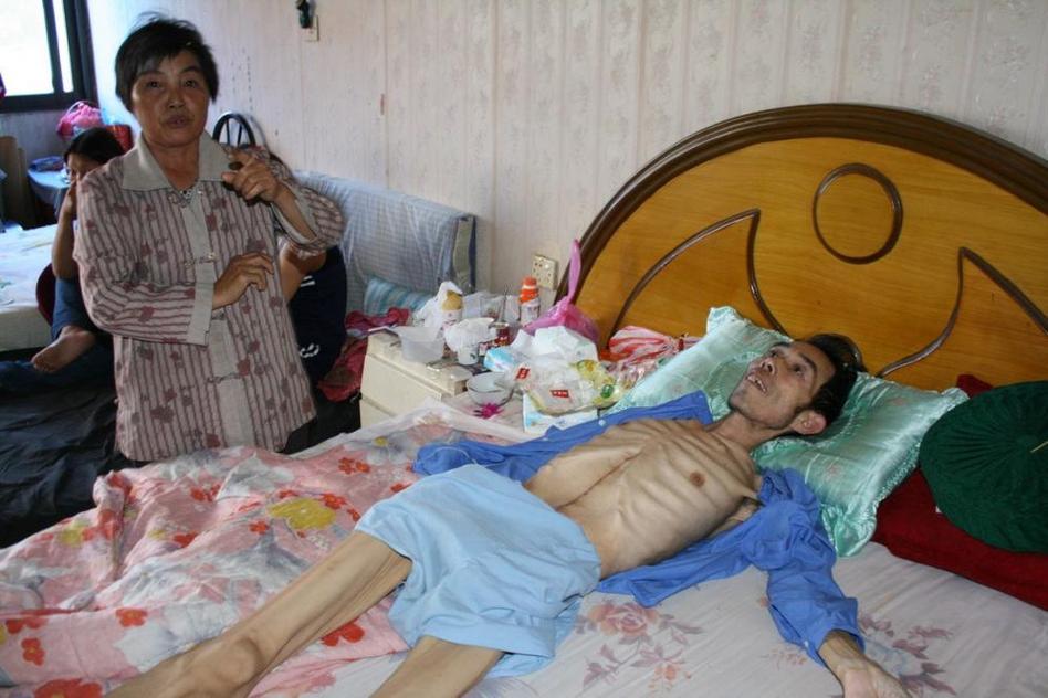 多地水污染嚴重 “癌癥村”人處境堪憂 多地水污染嚴重 “癌癥村”人處境堪憂