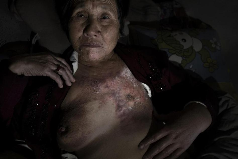 多地水污染嚴重 “癌癥村”人處境堪憂 多地水污染嚴重 “癌癥村”人處境堪憂