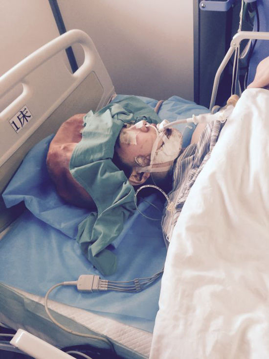 女海歸上海削骨整形 疑因術后出血誘發癲癇