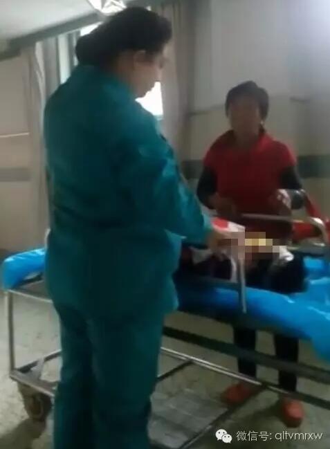 涵涵爸爸告訴《每日新聞》記者:“沒想到是熱水,大人也沒看,一時疏忽,掉進去了。抱出來的時候這個皮已經掉了。”