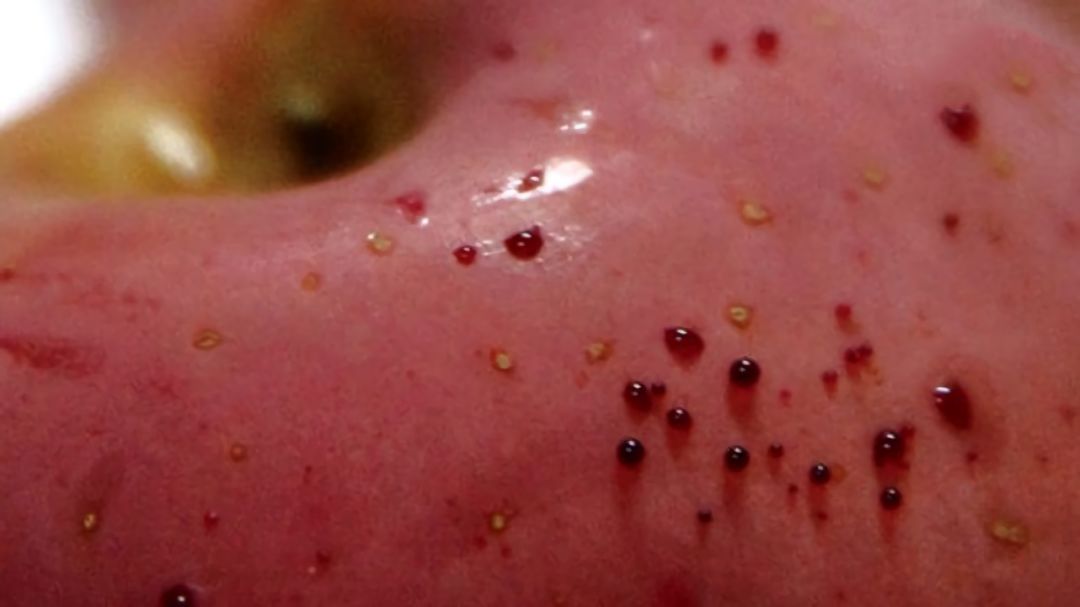 嚇懵！女子用熱水泡蘋果結(jié)果冒出血珠 咋回事？