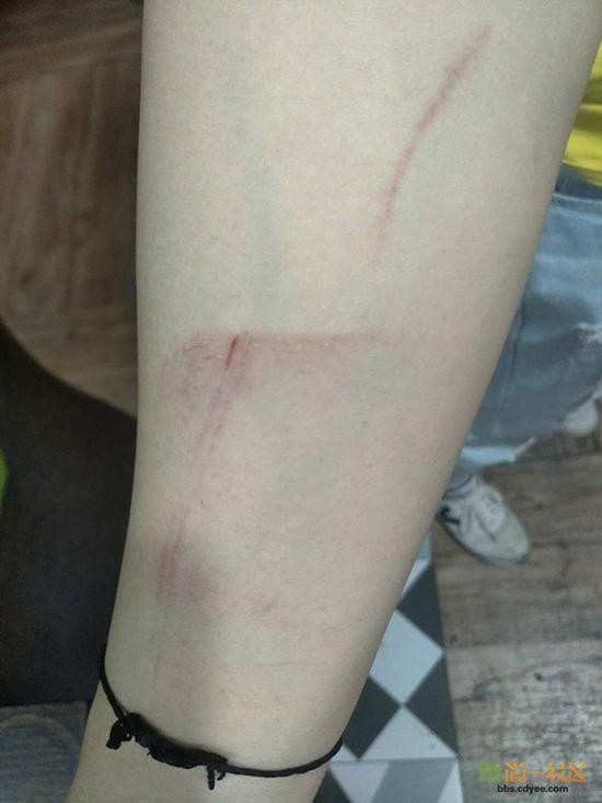 女網友舉報網帖中出示的被打后照片。