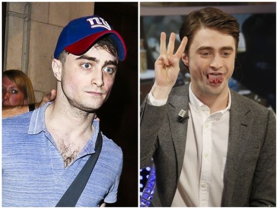 丹尼爾日前被拍到骨瘦如柴，不似2月份健康