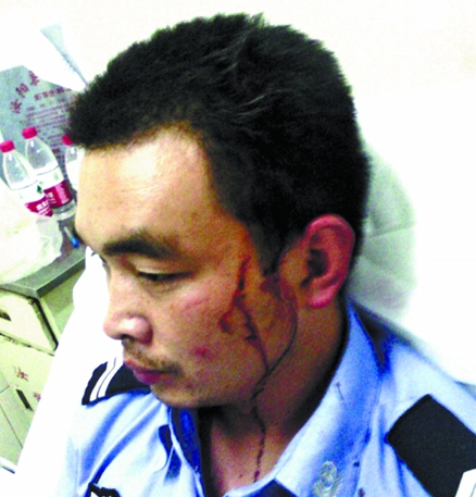 汝陽協警遭賭徒暴力抗法并圍毆 公安局稱這是內部的事 汝陽協警遭賭徒暴力抗法并圍毆 公安局稱這是內部的事