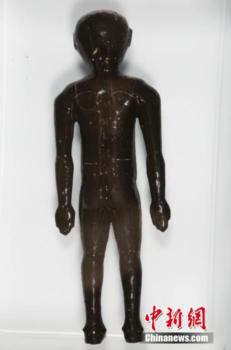 圖為出土的人體經穴漆俑。
