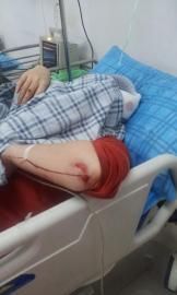 砸窗當事人胡女士在醫院接受治療。 砸窗當事人胡女士在醫院接受治療。