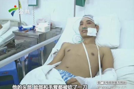 另一名傷者頭部、臉部和手臂都被砍了一刀。(視頻截圖) 另一名傷者頭部、臉部和手臂都被砍了一刀。(視頻截圖)