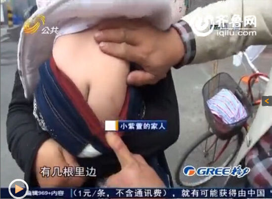 女嬰體內現16根鋼針無法取出 父母懷疑被下黑手 女嬰體內現16根鋼針無法取出 父母懷疑被下黑手