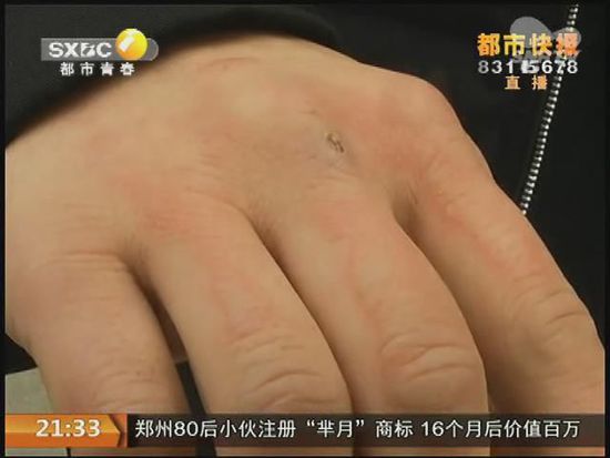 說到這足療拔罐，估計大伙都不陌生，但是想起4號晚上的拔罐的經歷，呂先生現在想起來，還心有余悸。