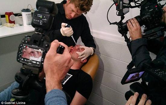 該實(shí)驗(yàn)是由加州一支名為“生物駭客”的實(shí)驗(yàn)團(tuán)隊(duì)開展的。他們使用了一種名為二氫卟吩e6（Ce6）的物質(zhì)的溶液。Ce6常見于深海魚體內(nèi)，有光敏特性，通常用于癌癥治療研究中。研究團(tuán)隊(duì)將Ce6與胰島素和鹽水混合起來，得到一種溶液，可以在低光照條件下提高人類的視力。