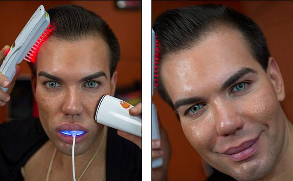 英男子為變“芭比男友”整容21次 英男子為變“芭比男友”整容21次